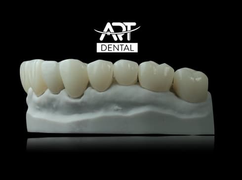 Slider image (7) Art Dental Care
